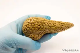 保护胰腺，就是守住“生命线”！医生：保护胰腺，从3件小事做起图片