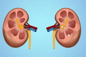 肾病检查：除了肌酐，这四个指标同样重要图片