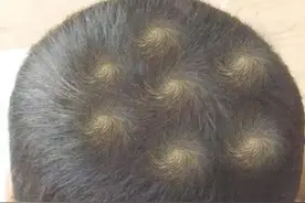 俗语“双顶男孩找不到，双顶女孩没人要”？你家孩子是双顶吗？图片