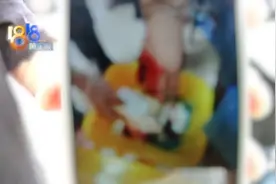 老乡找他干活 手指伤得不轻图片