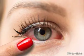 一个护眼中成药，解决眼睛干痒，发红，疼痛，治疗结膜炎，睑缘炎图片