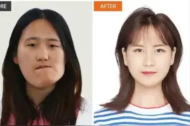 辽宁歪脸女孩整容后续，摇身一变成女神，拒当网红一心做老师图片