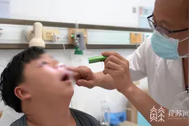 15岁少年脸肿又胀痛 竟是智齿长在鼻子里图片