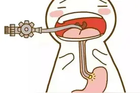 医生提醒：胃镜检查前后，你要注意这些事项图片