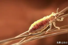 “虱子”与我们共存千万年，为何这几年见不到了？图片