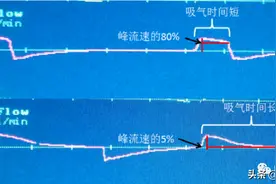 呼吸机：次要设置参数图片