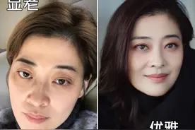 眼霜“抹”与“不抹”差别有多大？不差钱的，选这4款大牌就够了图片