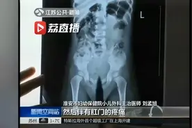 吃瓜子不吐壳导致肛门被卡，4天才“通”完图片