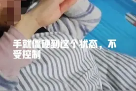 痔疮手术第一次排便，痛到残疾图片