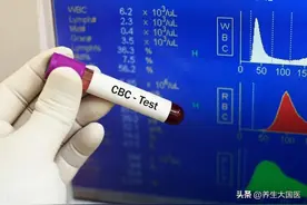 学看血常规 | 专家答疑：头晕就是贫血吗？为啥会贫血？补了铁剂为何还是贫血？图片