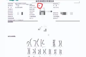 多年求子不得，中年男子查出染色体竟是“女儿身”，医生：罕见病图片