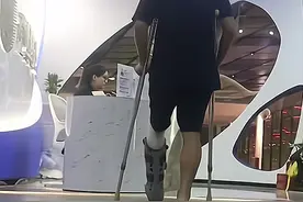 跟腱断裂的术后专业康复应该怎么做？图片