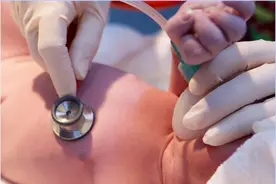 卡波西样血管内皮瘤，最要命的血管瘤之一图片