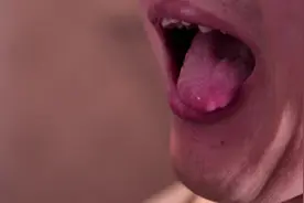 口腔溃疡反复发生，不要一再忍痛！医生治疗促进康复，大家学起来图片