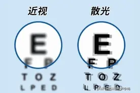 听说过同一只眼睛上既有近视，又有远视吗？图片
