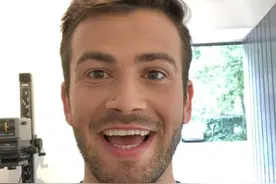 美国男子患上罕见脱毛症，半年里全身毛发通通掉光，成了"无毛人"图片