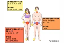 皮肤上这种小凸起，其实是 HPV 感染，太容易被忽略图片