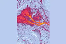 脉管炎是什么，该如何改善和预防？一文让你读懂图片