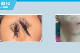 神奇！没想到身体这些部位也能长毛图片