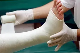 骨折后别慌，出现这4个迹象，说明正在正常愈合中图片