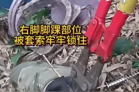 浙江衢州 一六旬老人上山时不慎踩到捕兽夹取不下来疼痛难忍，无奈报警求助图片