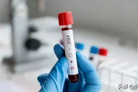 碰到艾滋病毒感染者的血，会被传染吗？图片
