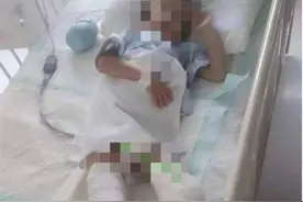 一级残疾还叫轻伤?「被生母虐待双腿截肢」敲下这些字，眼里含泪图片
