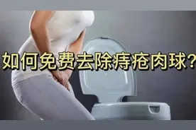 逆天神技能！！这套除痔方法简直开挂了！轻松消除痔疮毫不费力图片