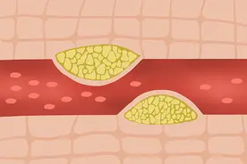 血管堵没堵，看头有提醒，头部出现4种变化，可能暗示脑血管堵了图片