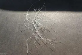 女性阴毛有什么用？由黑变白，预示着什么？医生告诉你答案图片