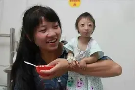 袖珍人梁小小：出生时仅2.1斤，被马戏团花5万块求购，如今怎样了图片