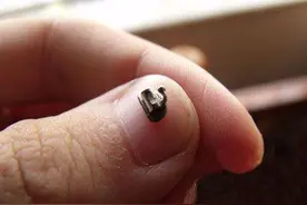 明明很小心，为什么托槽还是老掉？专家分析：问题出在这图片