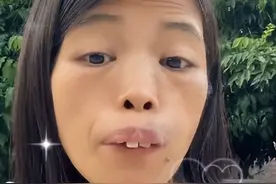 梅梅：靠“卖丑”出圈，圈粉百万成网红，龅牙被网友质疑是假牙图片