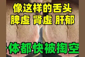 舌苔黄腻+舌侧鼓胀，脾肾虚、肝不通，身体都快被掏空了！图片