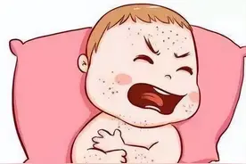 发烧、皮疹？“幼儿急疹”到底是怎么回事？图片