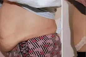 产后肚皮松弛？比心妈妈教你小妙招，拯救大肚皮图片