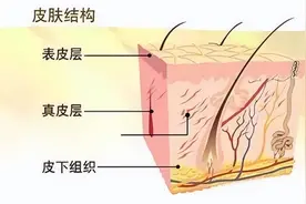 身体突然出现小红点，是疾病来临的信号吗？建议了解图片