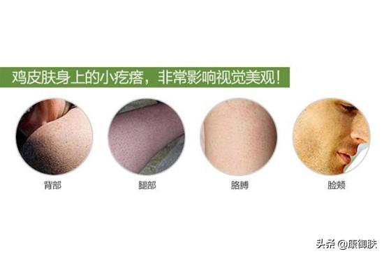 然后去除鸡皮疙瘩