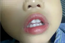 杭州家长扎堆干这事，影响颜值还伤智力图片