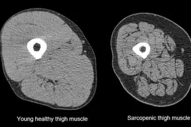 它被称为“人生最后一次骨折”，家里有老人的一定要注意！图片