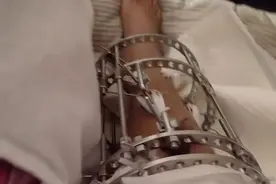 所有不幸都来自身高？“断骨增高”后的人：没有一天不后悔图片