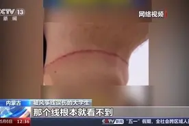 风筝线何以成“隐形刀”？平安放飞有讲究→图片