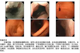 胸口像火烧一样！30岁女子每天喝它，出问题了图片