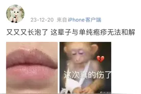 嘴上起水泡不是上火！小心是这种终身潜伏的病毒图片