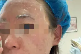 女子打水光针后过敏性休克！很多人爱打的水光针，风险这么大？图片