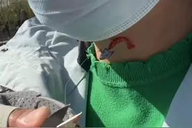 北京女子亮马河散步遭鱼钩扎脖已获赔付，如何避免悲剧再现？图片