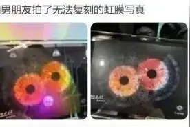 给眼珠拍写真？安全隐患不小！医生：不如来拍另一种图片