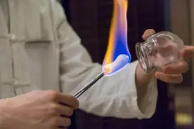 拔罐，罐印深浅并非指体内毒素，但也有说法！图片