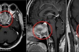 眼睛疼竟是脑袋“发霉”？上海人：出梅后也有黄梅病，高温天警惕这两种天气→图片