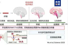 全球首次！复旦大学科研团队发现帕金森病全新治疗靶点图片